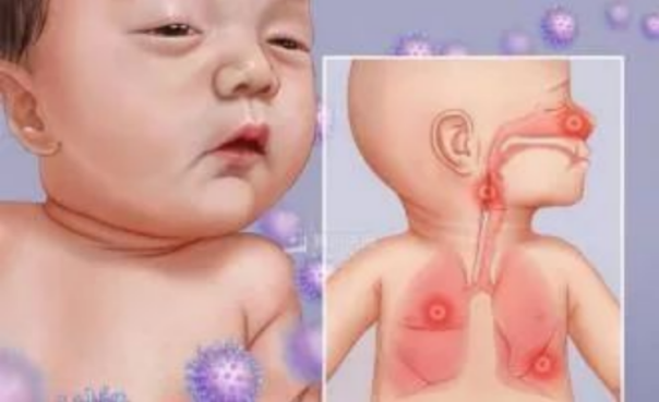 海迪生：秋季高发！“隐形杀手”RSV对儿童呼吸道健康的威胁与防护措施